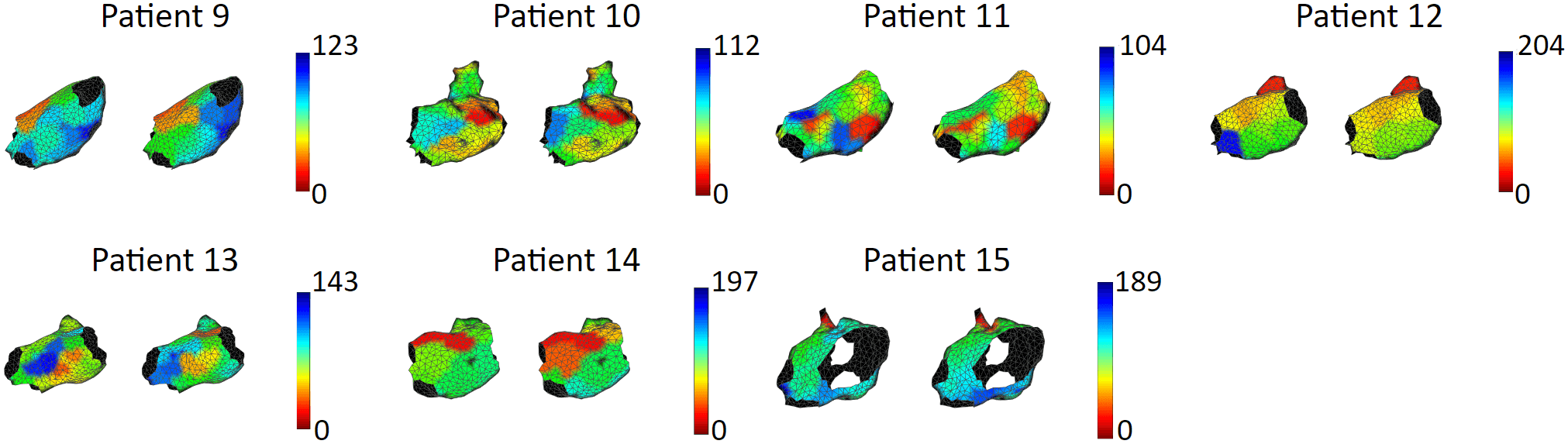 Patient simulation LAT maps – AT